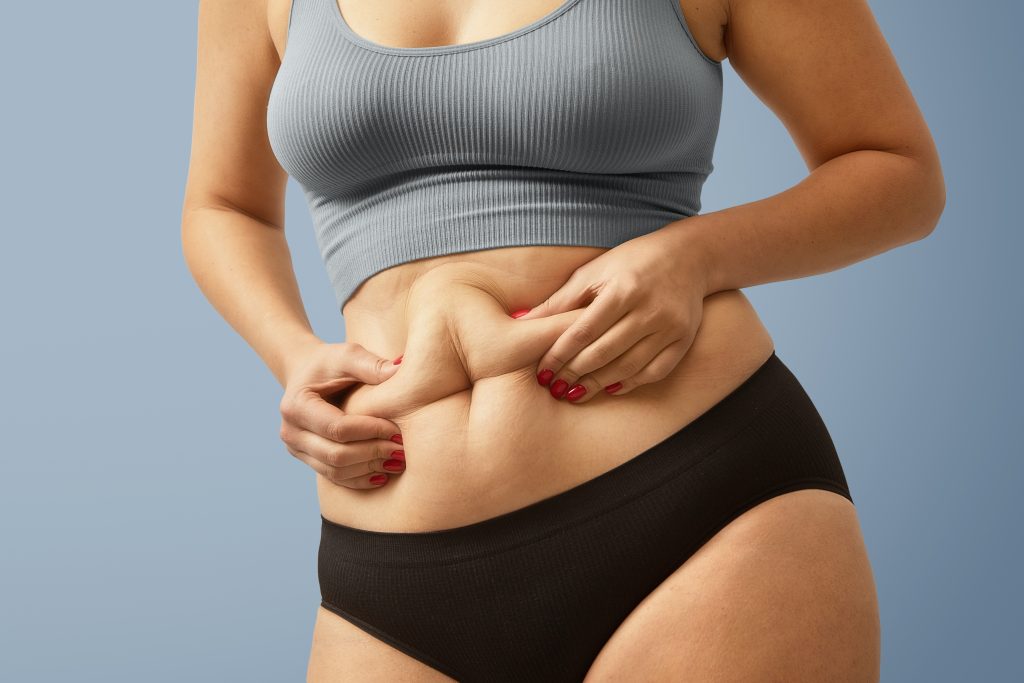 Operación de abdominoplastia con el Dr.Fernández Ibarburu en Pamplona